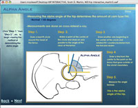 Calculating the Alpha Angle of the Hip